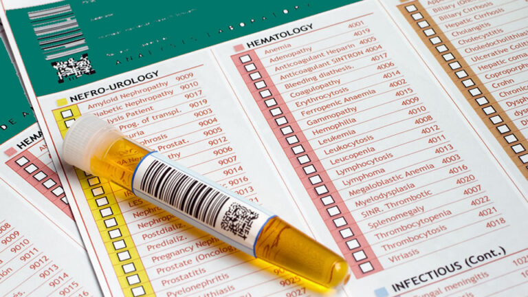 P03-Uroclinic-Craiova-Pregatirea pentru recoltarea de analize medicale din urina