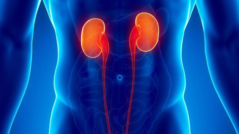 P08-Uroclinic-Craiova-Despre cancerul vezical