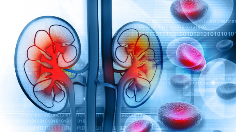 P09-Uroclinic-Craiova-Despre PSA seric - antigenul prostatic specific