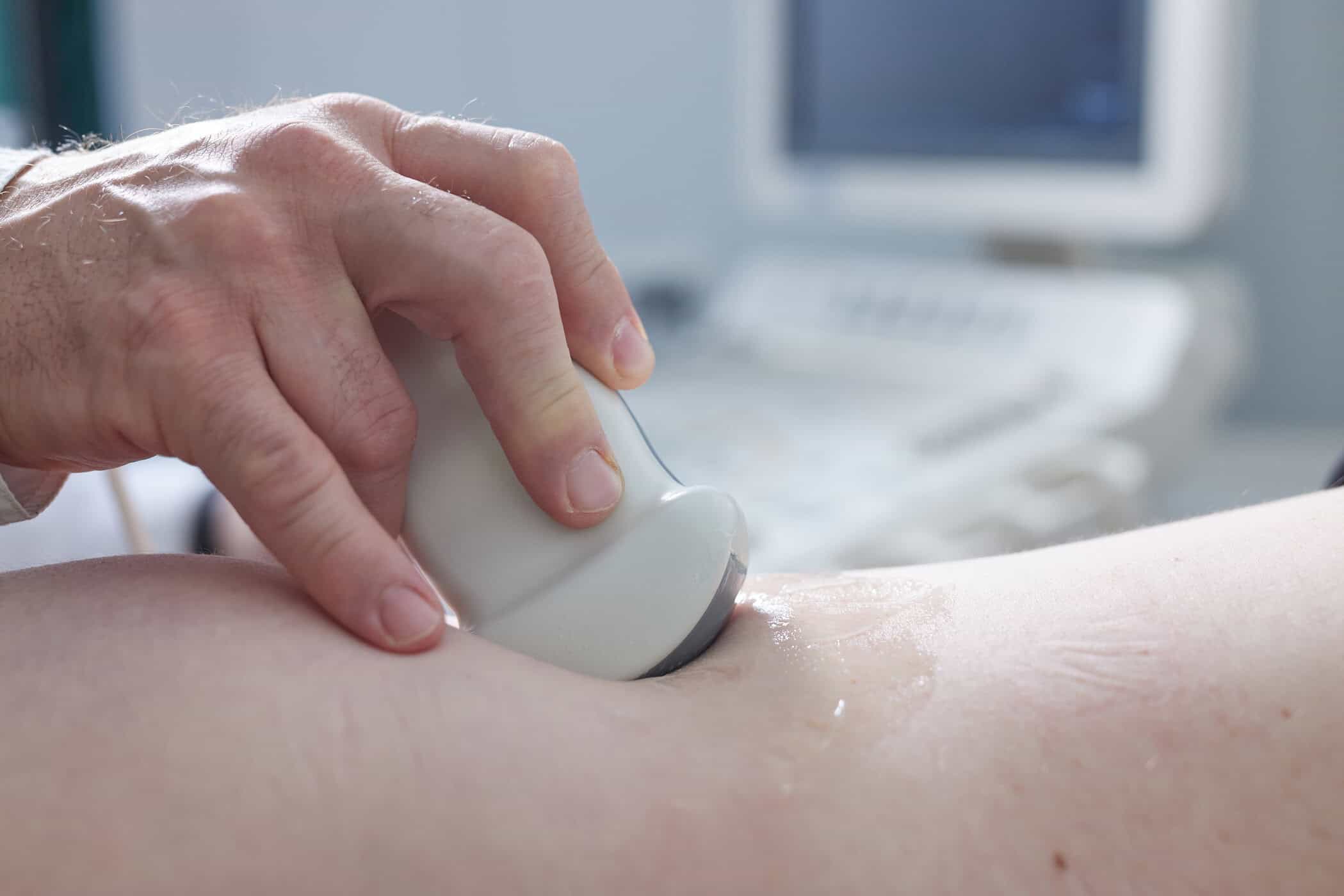 Pregatirea pentru ecografie - ecograf